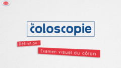 La coloscopie expliquée sous forme d’un court film, pour mieux appréhender cet examen