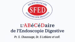 Application mobile « L’Abécédaire de l’Endoscopie Digestive », avec près de 90 fiches pratiques