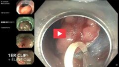 Replay des vidéo-sessions d’e-Vidéo-Digest