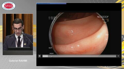 Amélioration des performances de la coloscopie : quels sont les outils réellement utiles ? (vidéo)