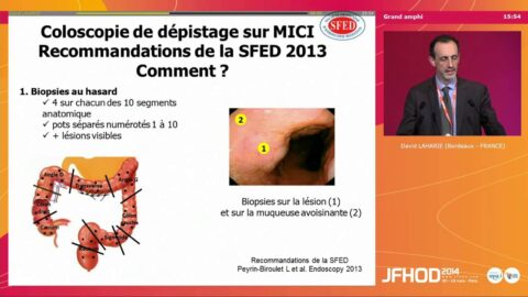 Dépistage et prise en charge de la dysplasie (vidéo)
