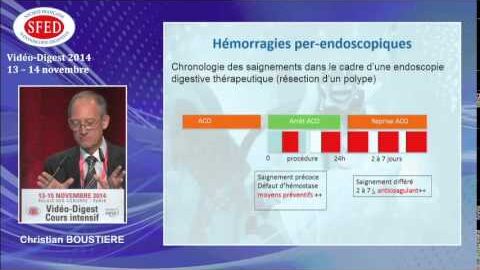 Endoscopie digestive et gestion des patients sous anti-coagulants (vidéo)