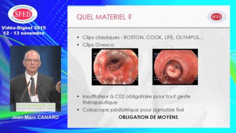 Gestion légale et médico-légale de la perforation colique : synthèse (vidéo)