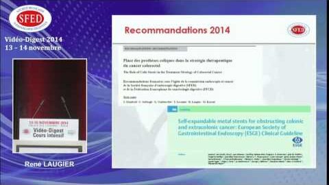 Indication des prothèses coliques dans la prise en charge des cancers colo-rectaux (vidéo)