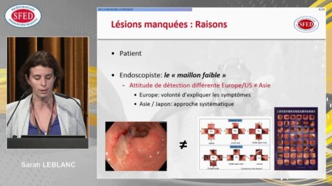 La qualité en œso-gastro-duodénoscopie (vidéo)