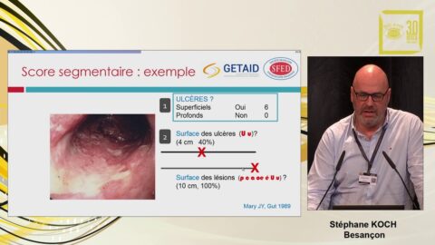 L'endoscopie pour la maladie de Crohn (vidéo)