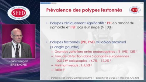 Les petits polypes colo-rectaux : épidémiologie