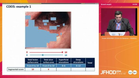 Les scores endoscopiques en pratique courante (vidéo)