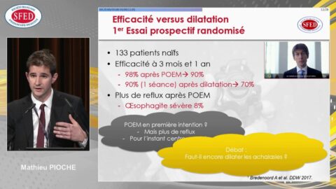 Prise en charge de l’achalasie en 2017 : place de l’endoscopie (vidéo)