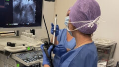 Inscription Curriculum Echo-Endoscopie Thérapeutique Avancée