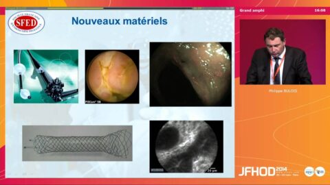Symposium de la SFED 2014 "Endoscopie des MICI : quand et comment ?" : synthèse et conclusion (vidéo)