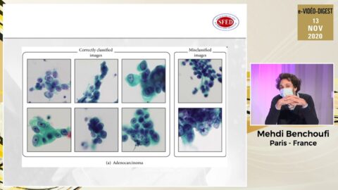 Symposium professionnel "Apport de l'intelligence artificielle pour la détection et la caractérisation des lésions du tube digestif" (vidéo)