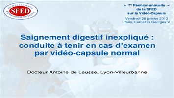 Saignement digestif inexpliqué : conduite à tenir en cas d'examen par vidéo-capsule normal