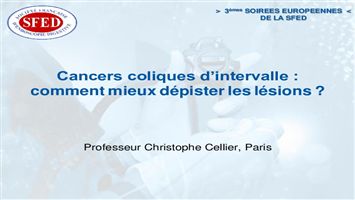 Cancers coliques d’intervalle : comment mieux dépister les lésions ?