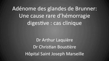 Résection d'un adénome des glandes de Brünner et hémostase par injection d'adrénaline puis pose d'une anse polyloop