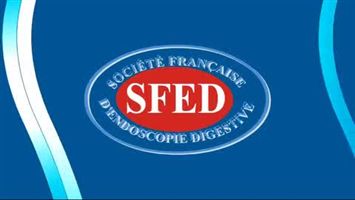 Thérapie photo-dynamique sur un cholangiocarcinome