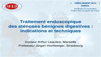 Traitement endoscopique des sténoses bénignes digestives : indications et technique