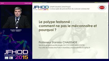 Le polype festonné : comment ne pas le méconnaître et pourquoi ? (vidéo)