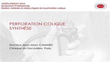 Gestion légale et médico-légale de la perforation colique : synthèse
