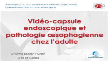 Vidéo-capsule et pathologie œsophagienne chez l’adulte