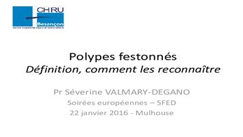 Polypes festonnés : définition