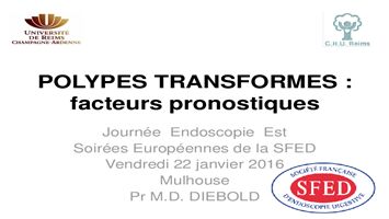 Polypes transformés : facteurs pronostiques
