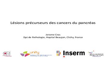 Lésions précurseurs des cancers du pancréas