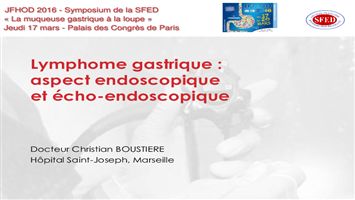 Lymphome gastrique : aspect endoscopique et écho-endoscopique