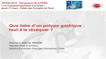 Que faire d’un polype gastrique : faut-il le réséquer ?