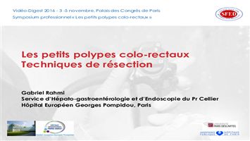 Les petits polypes colo-rectaux : techniques de résection