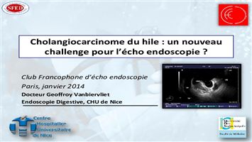 Cholangiocarcinome du hile : un nouveau challenge pour l'écho-endoscopie ?