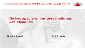Vidéo-capsule et tumeurs malignes : cas cliniques