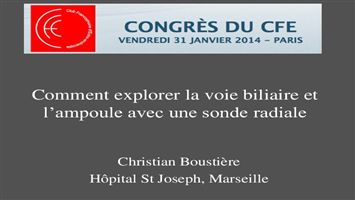 Comment explorer la voie biliaire et l’ampoule de Vater avec une sonde radiale ?