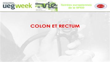 Retour sur l’UEGW 2016 : côlon et rectum