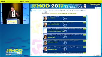 Analyse critique du dépistage de la dysplasie sur MICI (vidéo)