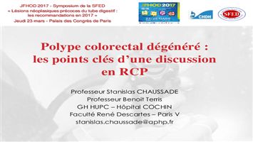 Polype colo-rectal dégénéré : les points clés d’une discussion en réunion de concertation pluridisciplinaire