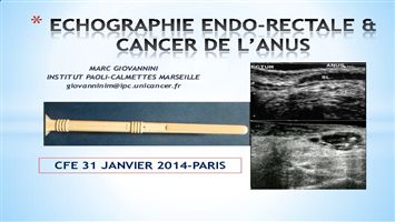 Echographie endo-rectale et cancer de l'anus