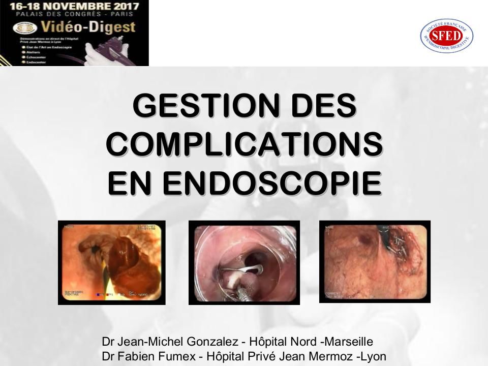 Gestion des complications en endoscopie digestive