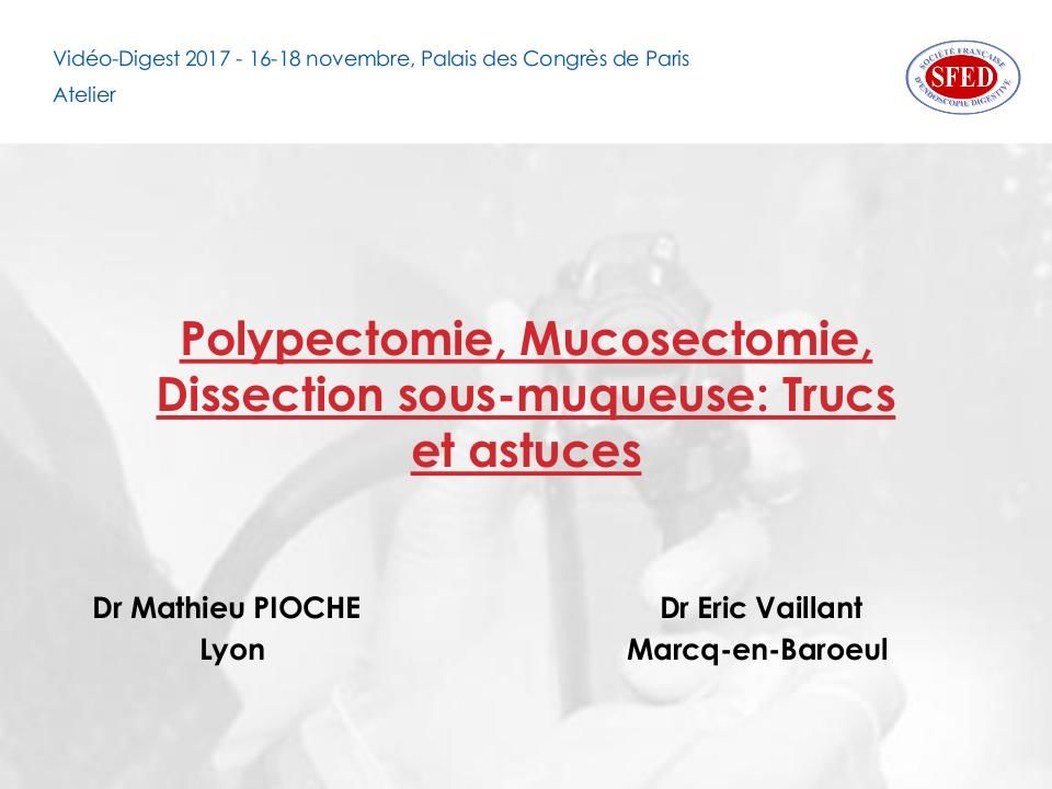 Polypectomie
