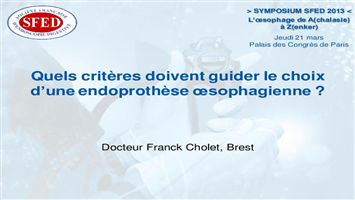 Quels critères doivent guider le choix d'une prothèse œsophagienne ?