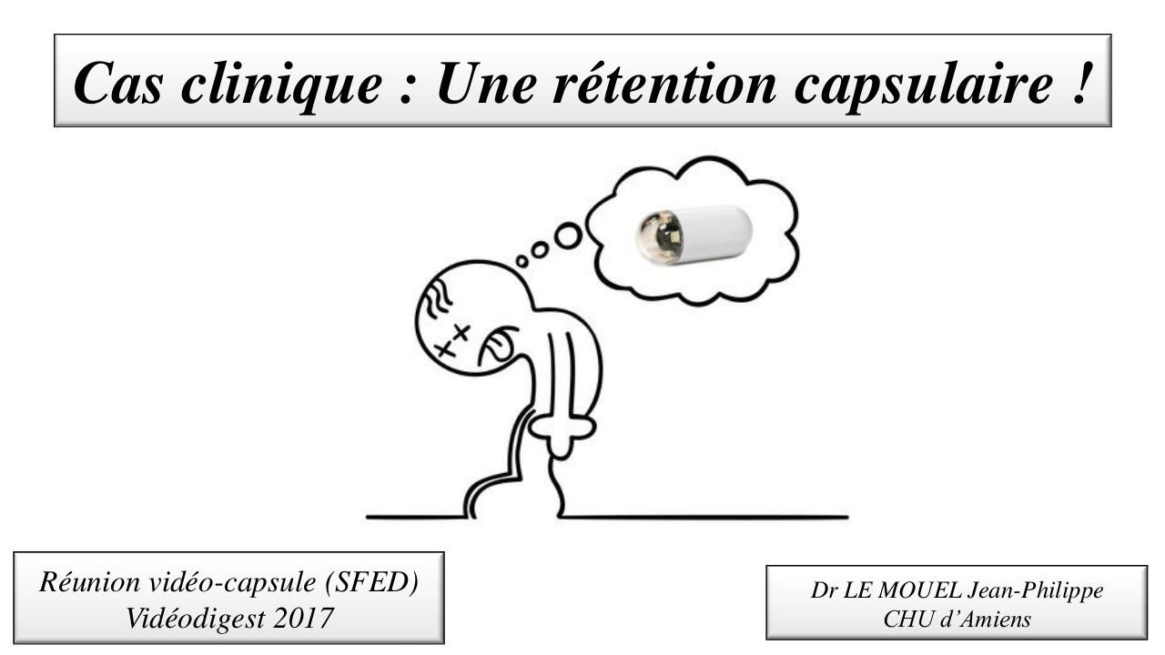 Cas clinique : un cas de rétention de la vidéo-capsule