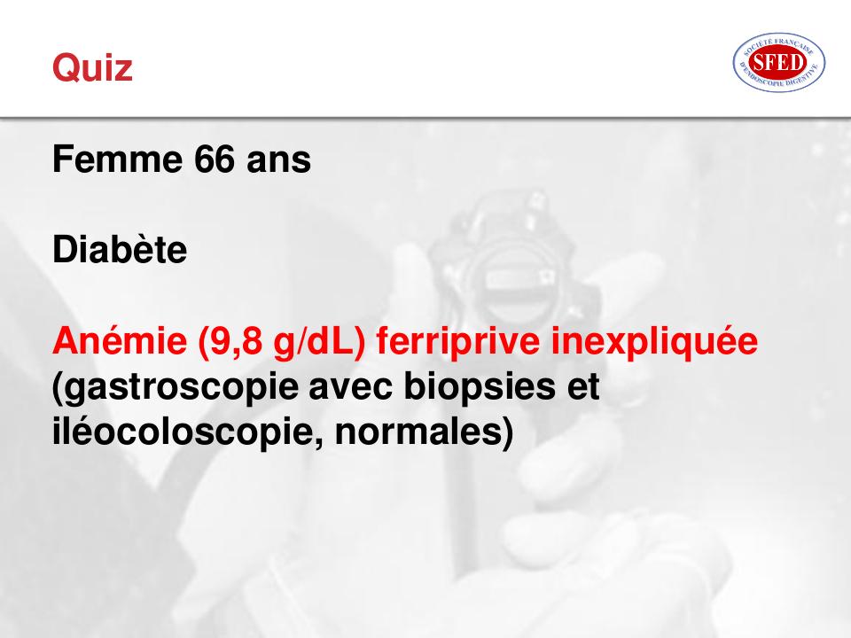 Cas clinique sur une angiectasie minuscule