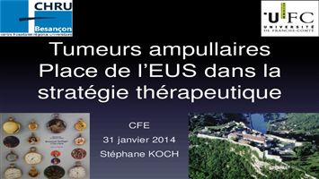 Tumeurs ampullaires : place de l’écho-endoscopie dans la stratégie thérapeutique