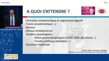 Traitement endoscopique des complications de la chirurgie bariatrique (vidéo)