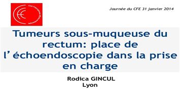 Tumeurs sous-muqueuse du rectum : place de l'écho-endoscopie dans la prise en charge