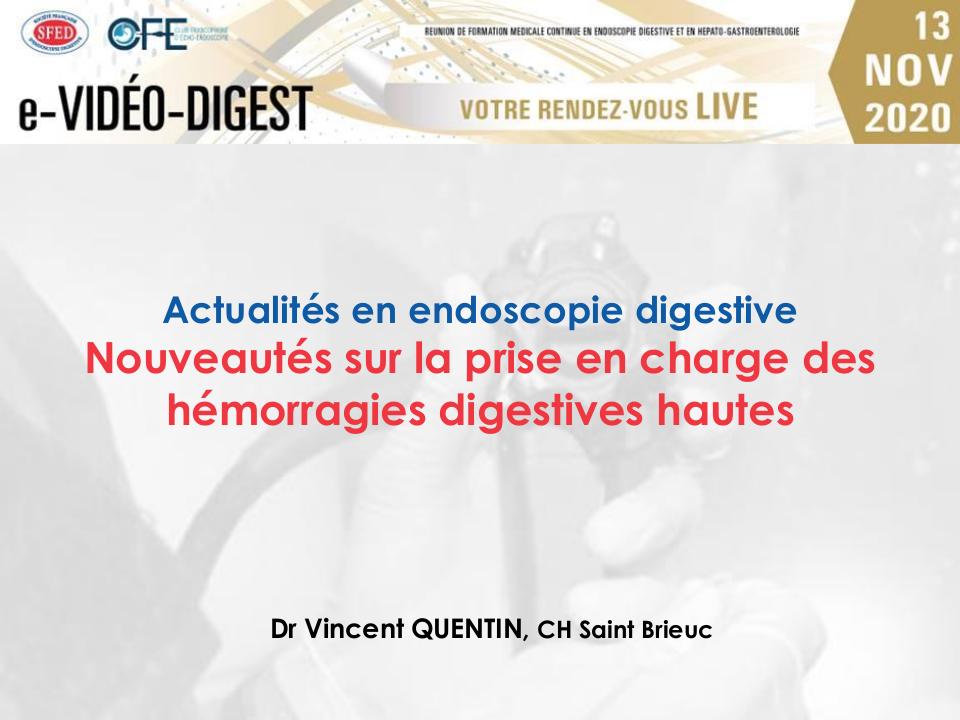 Nouveautés dans la prise en charge des hémorragies digestives hautes