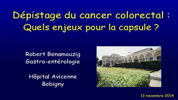 Dépistage du cancer colo-rectal : quels enjeux pour la vidéo-capsule ?