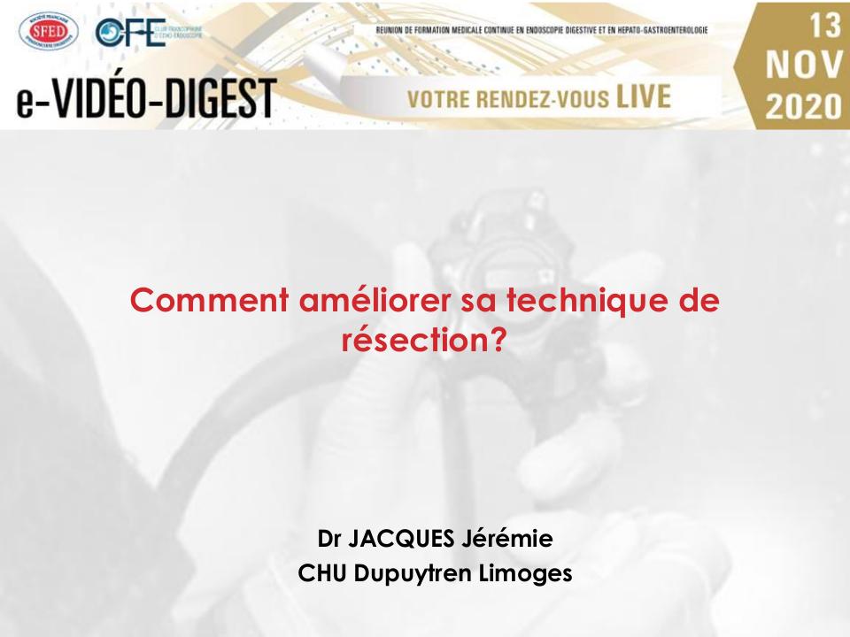 Comment améliorer sa technique de résection ?