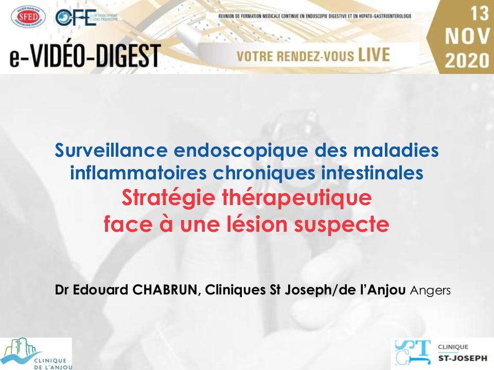 Surveillance endoscopique des MICI : stratégie thérapeutique face à une lésion suspecte