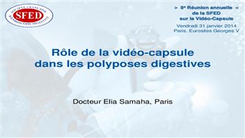 Rôle de la vidéo-capsule dans les polyposes digestives